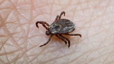 Climate change could cause spike in ticks - and drive up Lyme disease cases