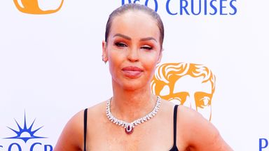 Katie Piper forced to pull out of ITV show for 'unexpected medical procedure'