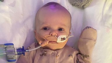 Parents of 11-week-old baby who needs an urgent heart transplant urge people to become donors