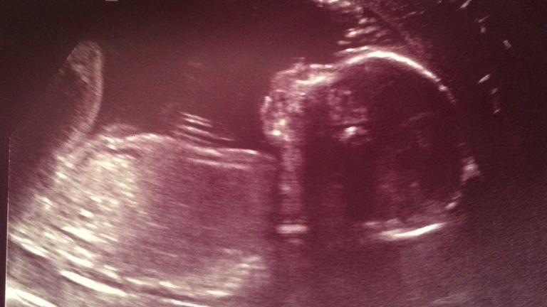 Parents angry no one held accountable for stillborn baby's care - amid fears NHS's 'religion' status is 'dangerous'